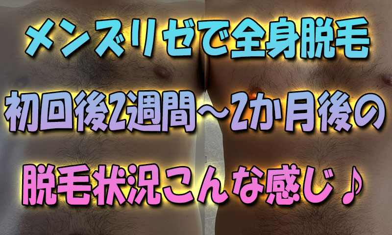 【メンズリゼでガチ全身脱毛】初回後2週間～2か月後の実際の脱毛状況の写真