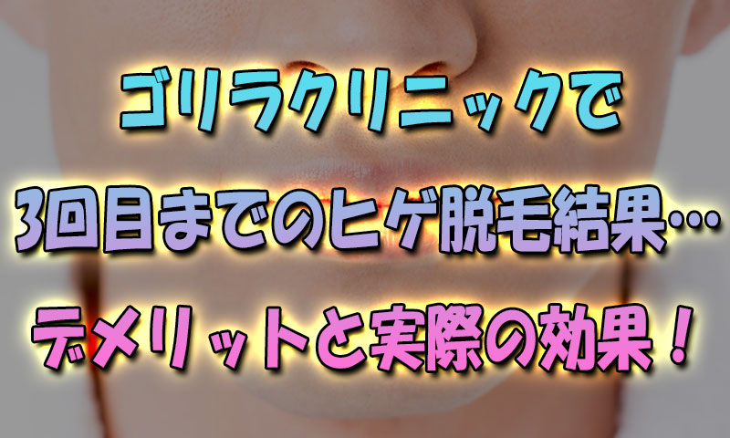 ゴリラクリニックで3回目までのヒゲ脱毛状況…デメリットと実際の効果はこんな感じ