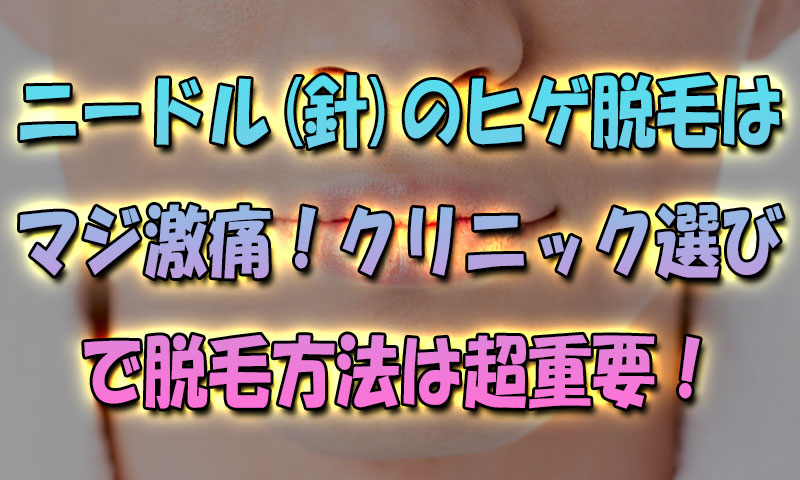 ニードル針ヒゲ脱毛はマジ激痛！クリニック選びで脱毛方法は超重要だから！