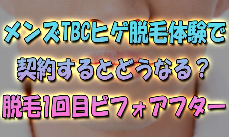 メンズTBCヒゲ脱毛体験で契約するとどうなる？脱毛1回目ビフォアフター