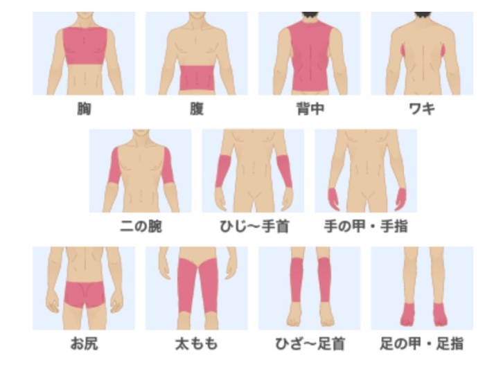 メンズリゼの全身脱毛を受けた部位_700