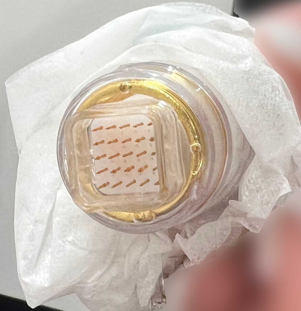 ポテンツァの施術に使った針